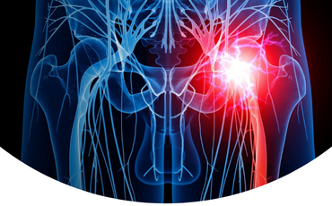 Ceinture PhysioMedic - Sciatique et douleur du bas du dos