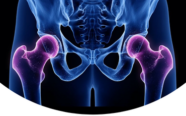 Ceinture PhysioMedic - Sciatique et douleur du bas du dos