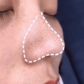 MASQUE PEAU PARFAITE - NYZARA