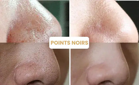 MASQUE PEAU PARFAITE - NYZARA