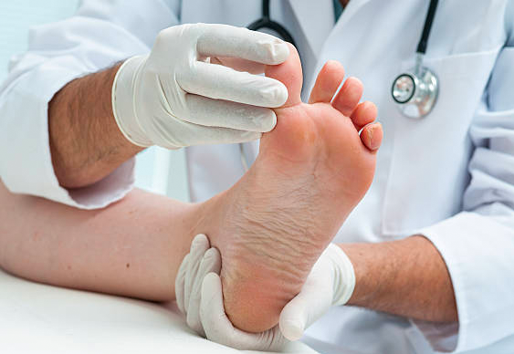 OrthoChausse Attelle d'oignon instantanÃ©e