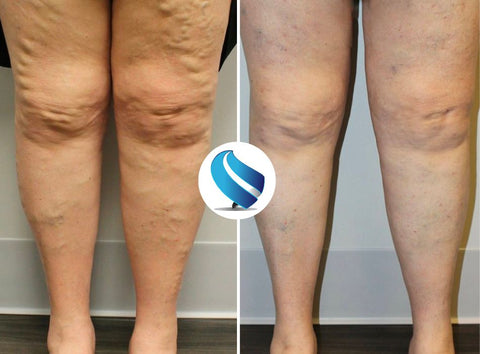 Postur Masseur de Pieds - Pour un soulagement durable de la douleur aux pieds