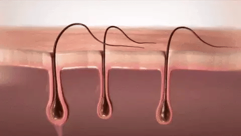 Ã‰pilateur IPL pour Hommes - Namido