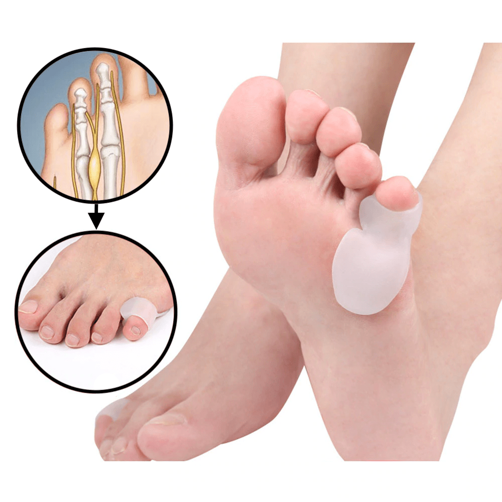 correcteur orthopdique pour quintus varus c9iuy