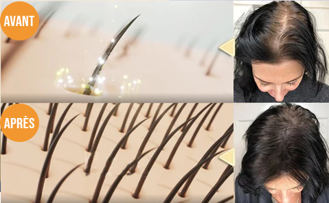 Shampoing Solide Repousse ExtrÃªme - by Nyzara