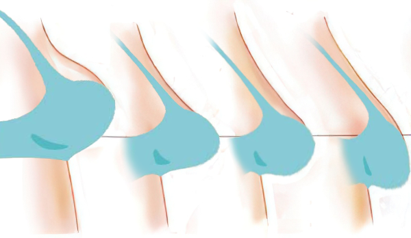 Vavou | Soutien-gorge anti-affaissement | 1 + 2 GRATUITS