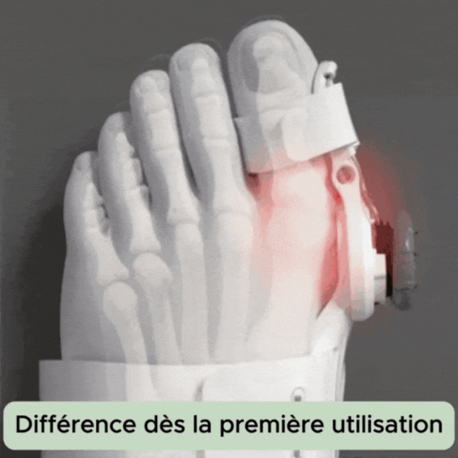 Correcteurs pour l'hallux valgus