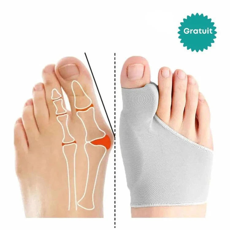 Correcteur universel pour hallux valgus