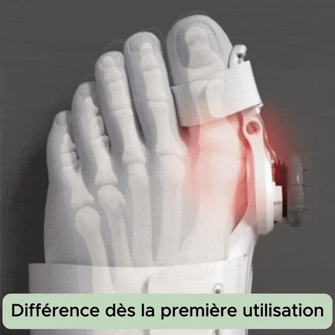Correcteur universel pour hallux valgus